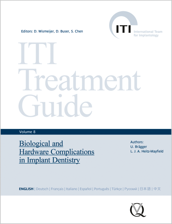 Wismeijer: Biological and Hardware Complications in Implant Dentistry