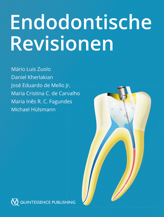 Zuolo: Endodontische Revisionen