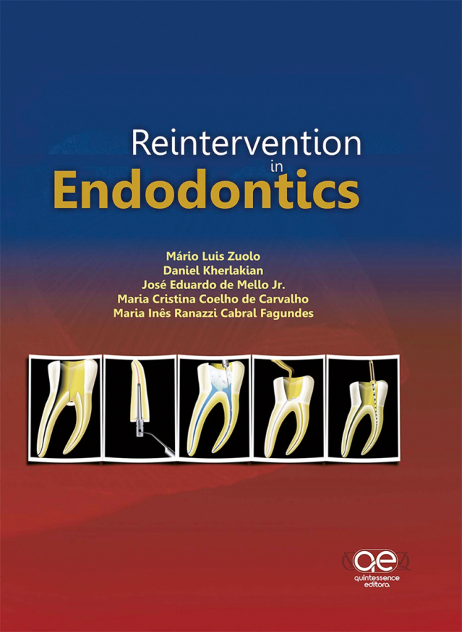Zuolo: Reintervention in Endodontics