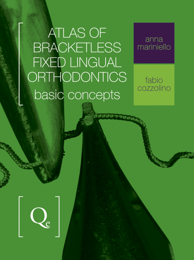Mariniello: Atlas of Bracketless Fixed Lingual Orthodontics