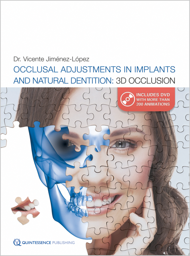 Jiménez-López: Occlusal Adjustments in Implants and Natural Dentition: 3D Occlusion