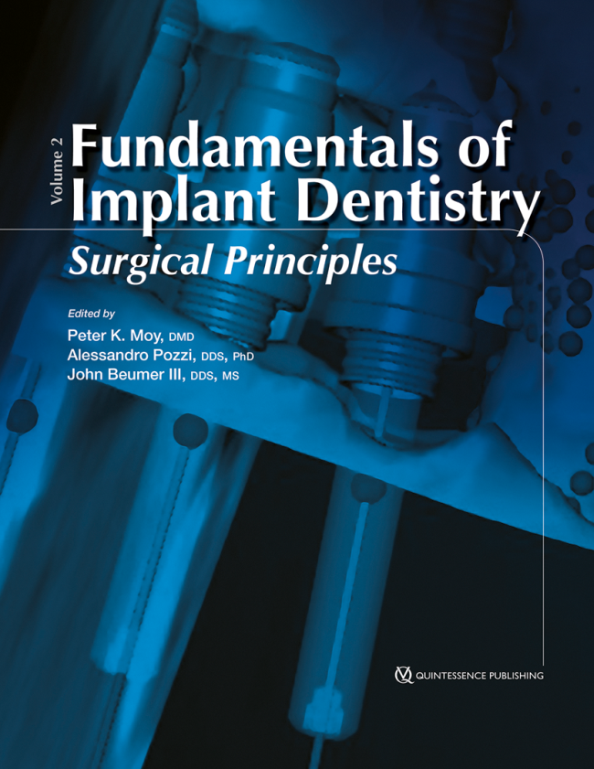 Moy: Fundamentals of Implant Dentistry Volume 2