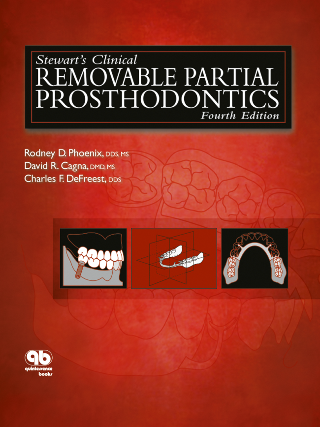 Phoenix: Stewarts Clinical Removable Partial Prosthodontics