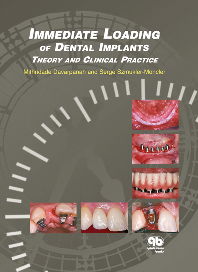 Davarpanah: Immediate Loading of Dental Implants