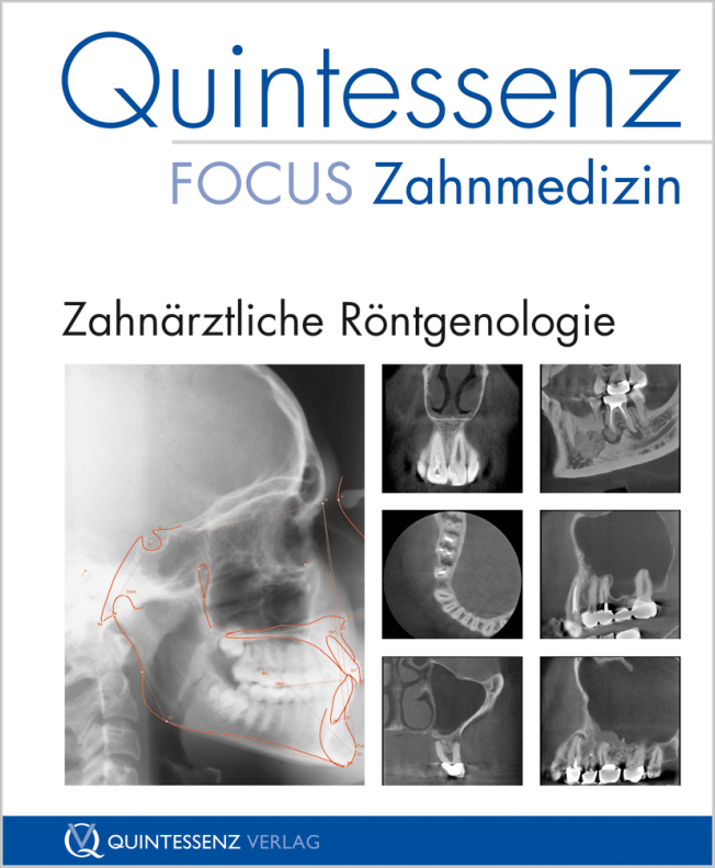 Schulze: Zahnärztliche Röntgenologie