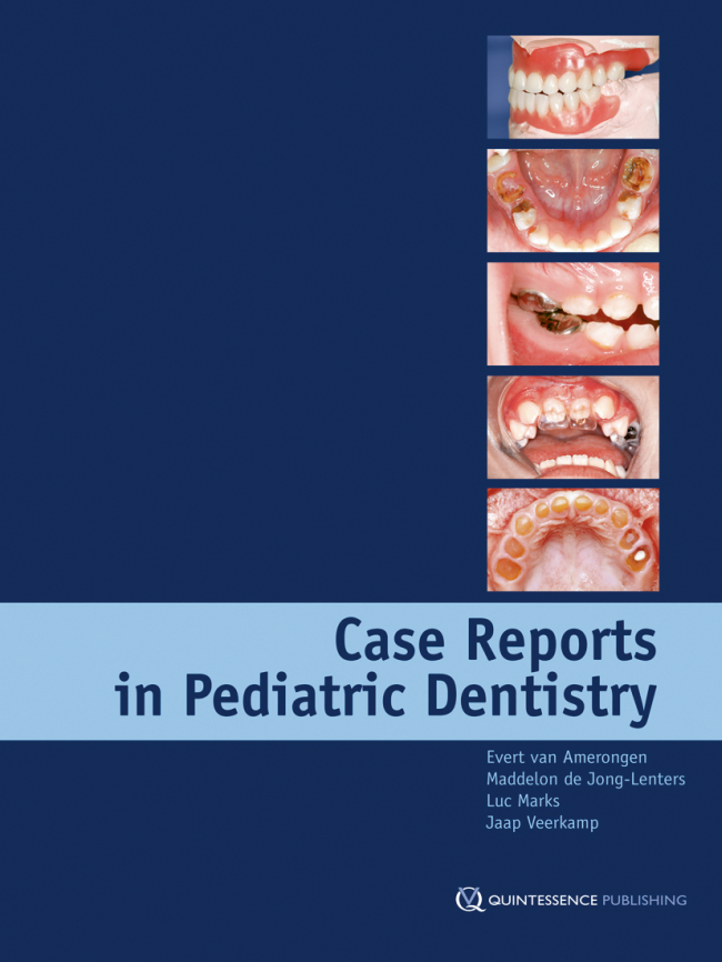 van Amerongen: Case Reports in Pediatric Dentistry