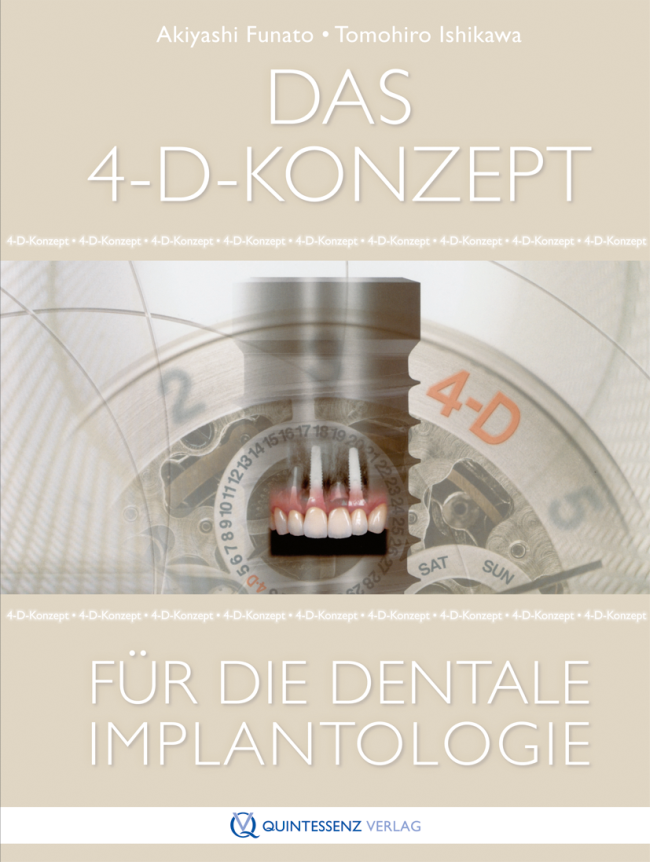 Funato: Das 4-D-Konzept für die dentale Implantologie