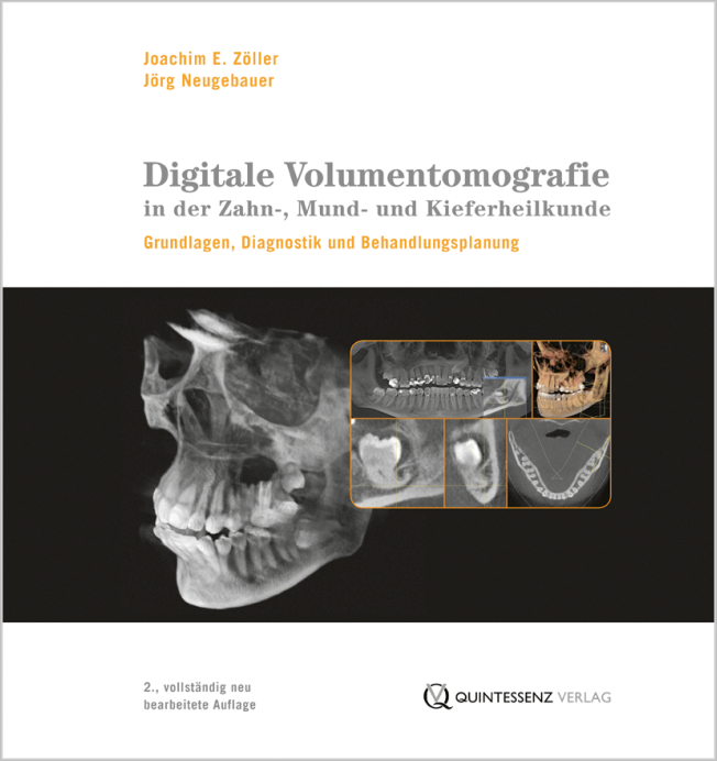 Zöller: Digitale Volumentomografie in der Zahn-, Mund- und Kieferheilkunde