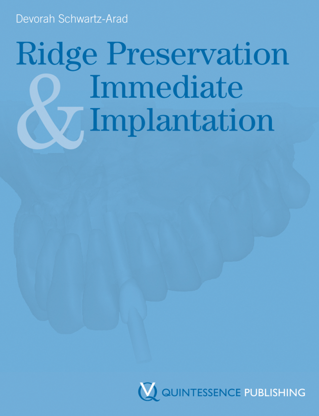 Schwartz-Arad: Ridge Preservation and Immediate Implantation