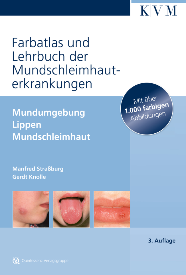 Straßburg: Farbatlas und Lehrbuch der Mundschleimhauterkrankungen
