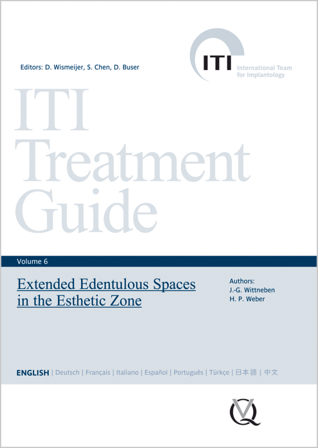 Wismeijer: Extended Edentulous Spaces in the Esthetic Zone