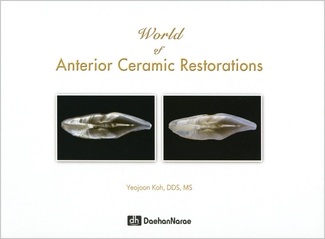 Koh: World of Anterior Ceramic Restorations