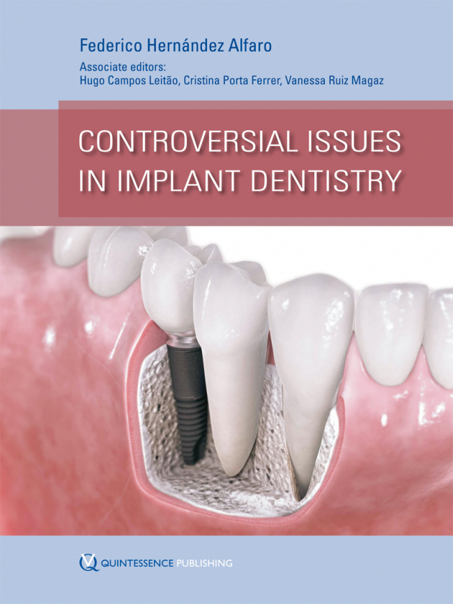 Alfaro: Controversial Issues in Implant Dentistry