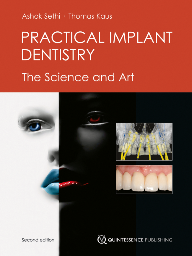 Sethi: Practical Implant Dentistry