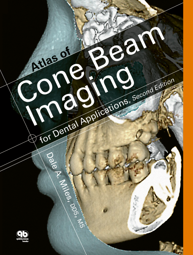 Miles: Atlas of Cone Beam Imaging for Dental Applications