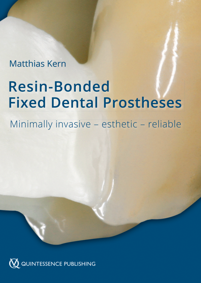 Kern: Resin-Bonded Fixed Dental Prostheses