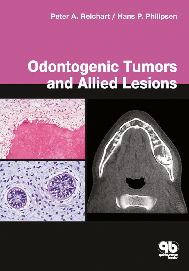 Reichart: Odontogenic Tumors and Allied Lesions