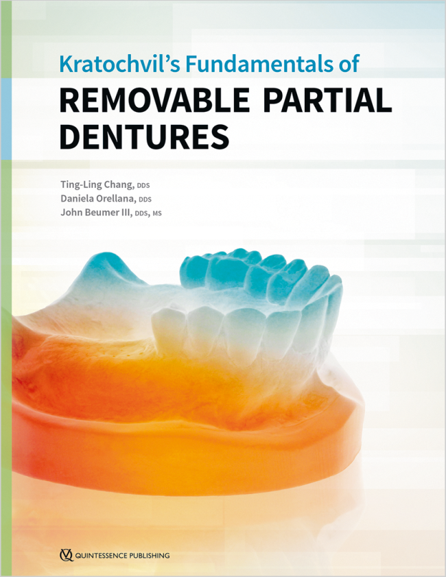 Chang: Kratochvils Fundamentals of Removable Partial Dentures