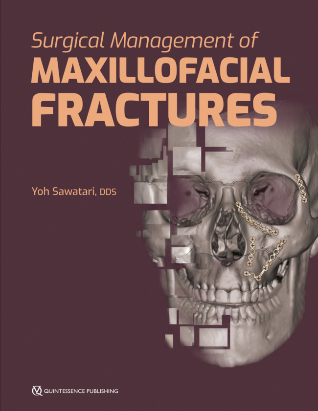 Sawatari: Surgical Management of Maxillofacial Fractures
