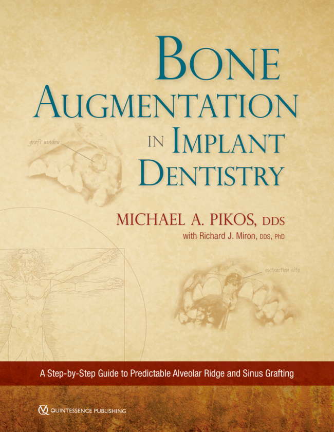 Pikos: Bone Augmentation in Implant Dentistry