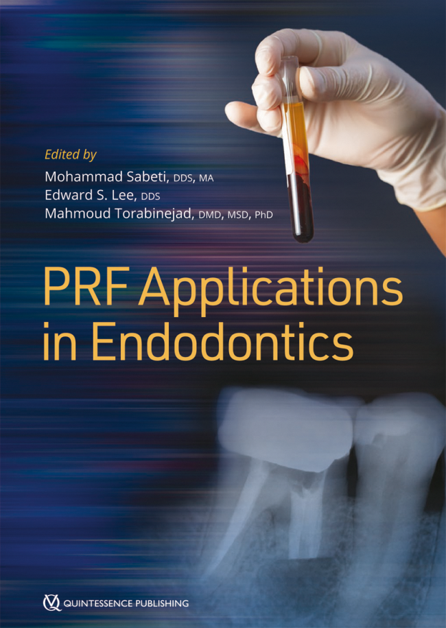 Sabeti: PRF Applications in Endodontics