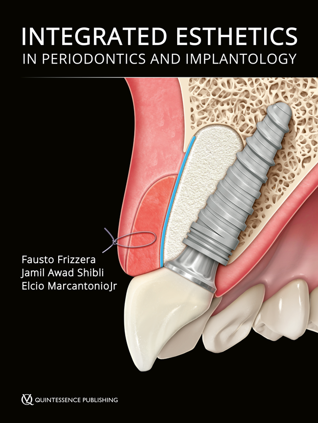 Frizzera: Integrated Esthetics in Periodontics and Implantology