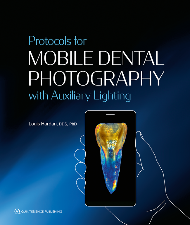 Hardan: Protocols for Mobile Dental Photography with Auxiliary Lighting