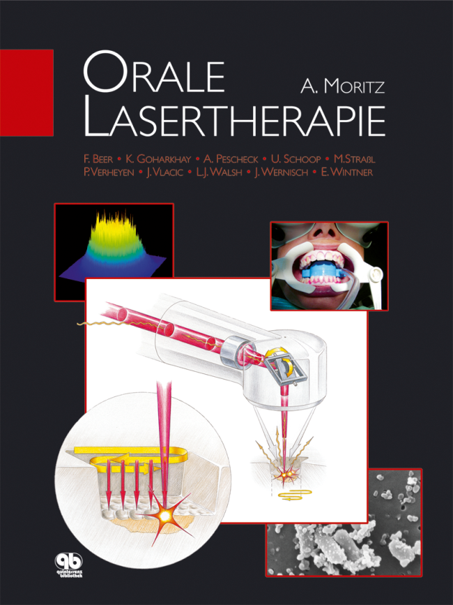 Moritz: Orale Lasertherapie