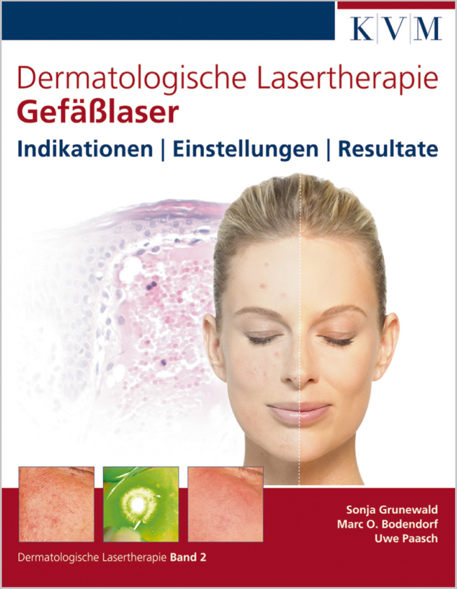 Grunewald: Dermatologische Lasertherapie