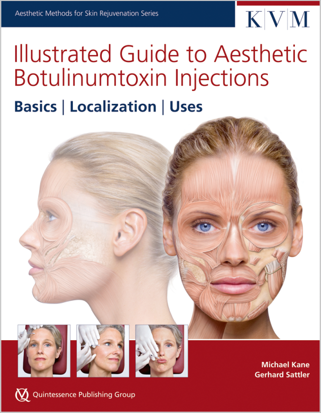 Kane: Illustrated Guide to Aesthetic Botulinumtoxin Injections