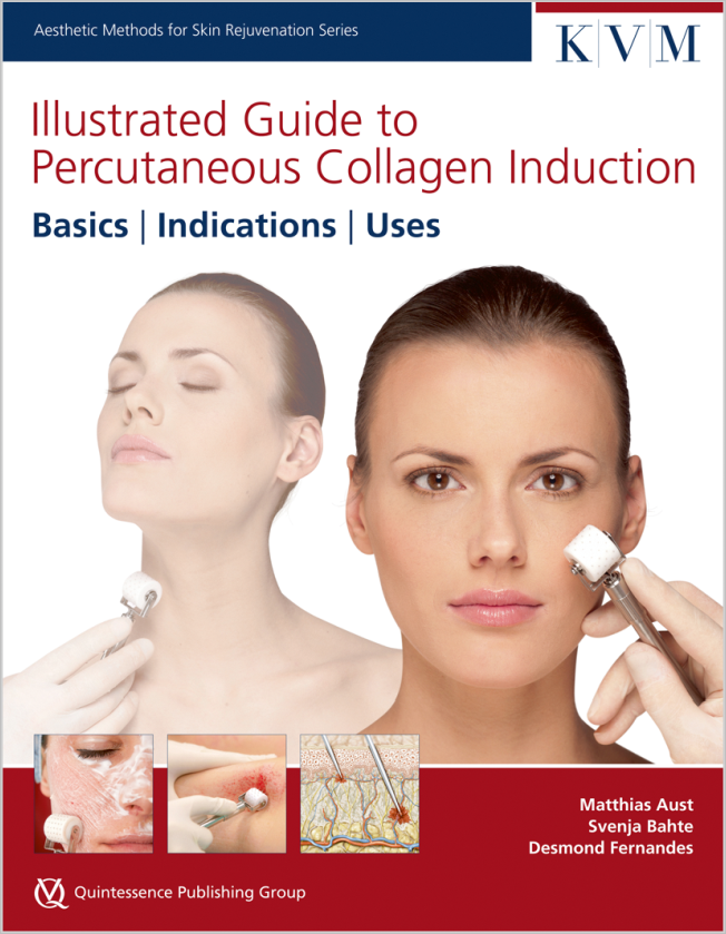 Aust: Illustrated Guide to Percutaneous Collagen Induction