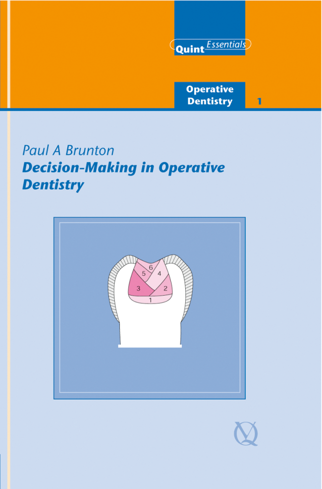 Brunton: Decision-Making in Operative Dentistry