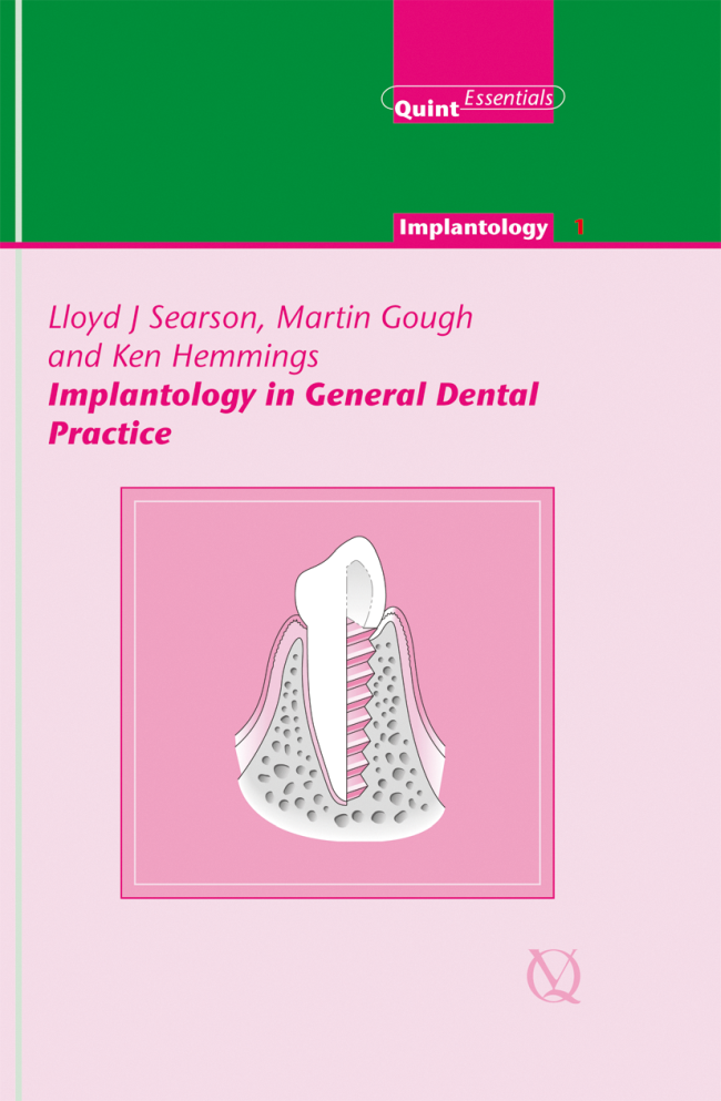 Searson: Implantology in General Dental Practice