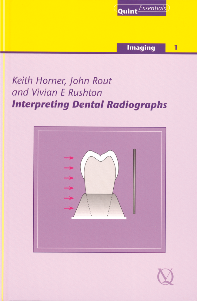 Horner: Interpreting Dental Radiographs
