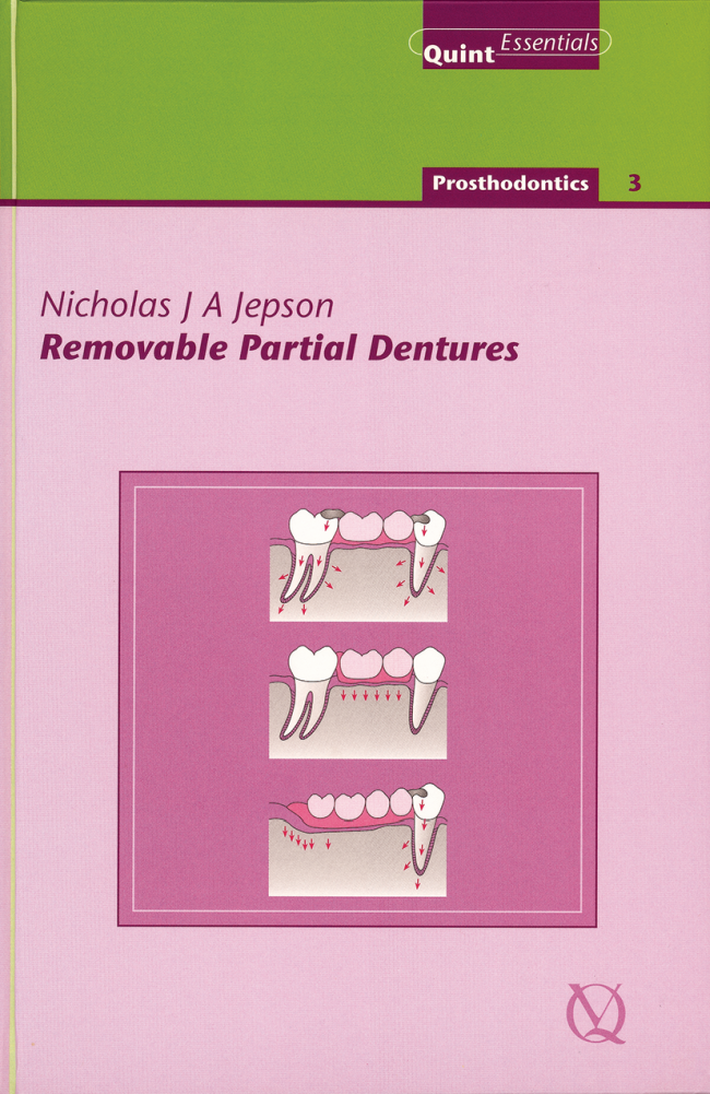 Jepson: Removable Partial Dentures