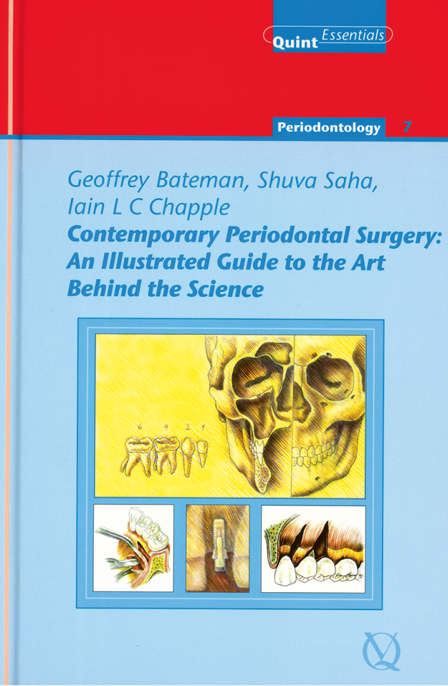 Bateman: Contemporary Periodontal Surgery