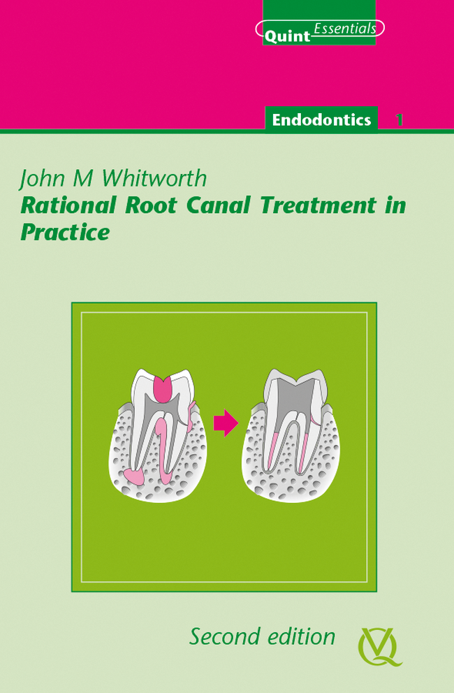 Whitworth: Rational Root Canal Treatment in Practice