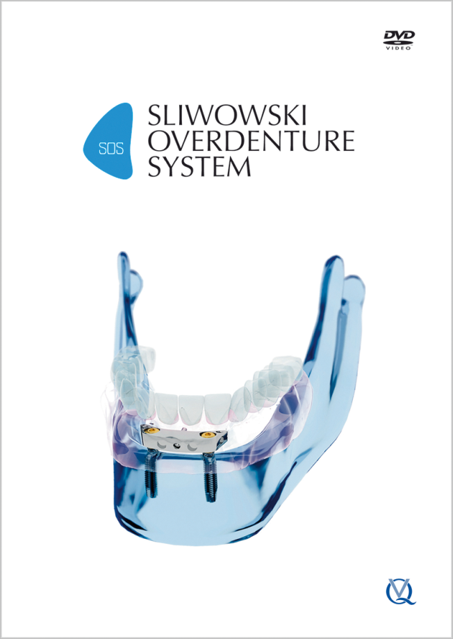 Sliwowski: SOS - Sliwowski Overdenture System