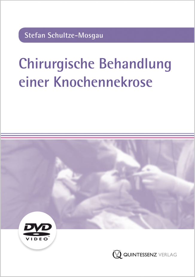 Schultze-Mosgau: Chirurgische Behandlung einer Knochennekrose