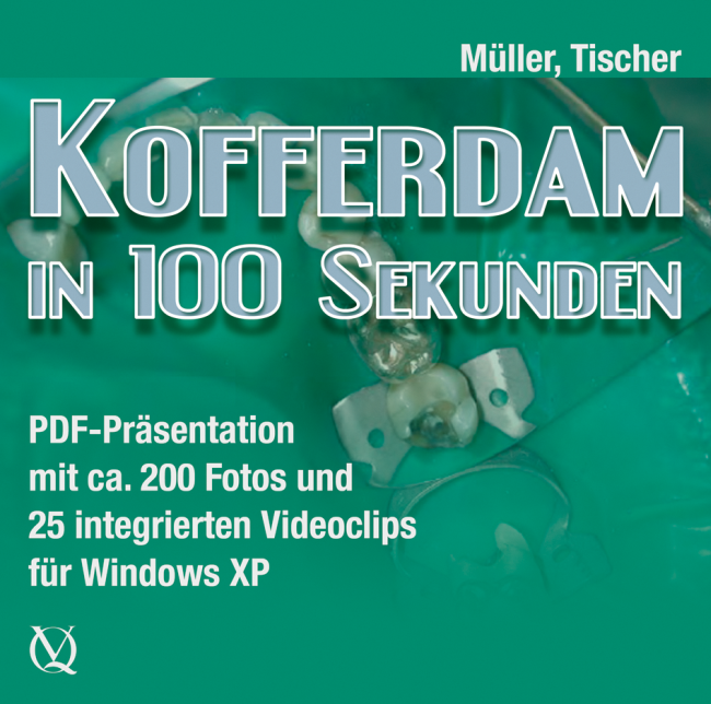 Müller: Kofferdam in 100 Sekunden | Rubber Dam in Only 100 Seconds