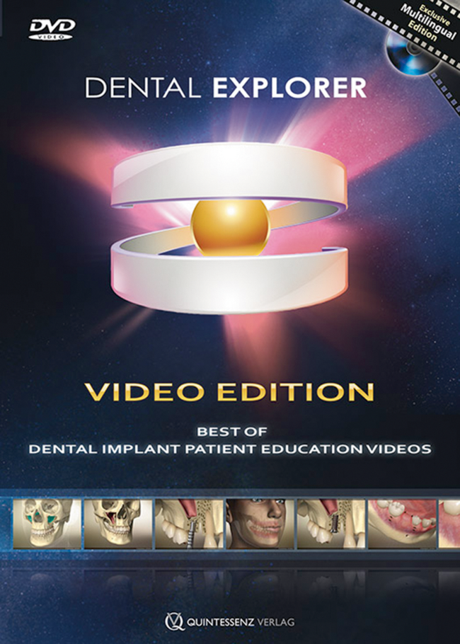 Bengel: Dental Explorer Video Edition