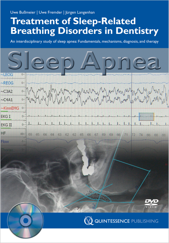 Bußmeier: Sleep Apnea