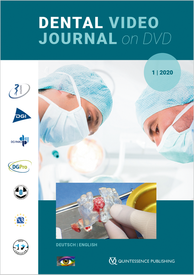 (DGZMK): Dental Video Journal 1/2020