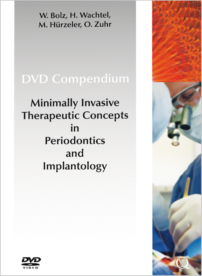 Bolz: Minimally Invasive Treatment Concepts in Periodontics and Implant Dentistry