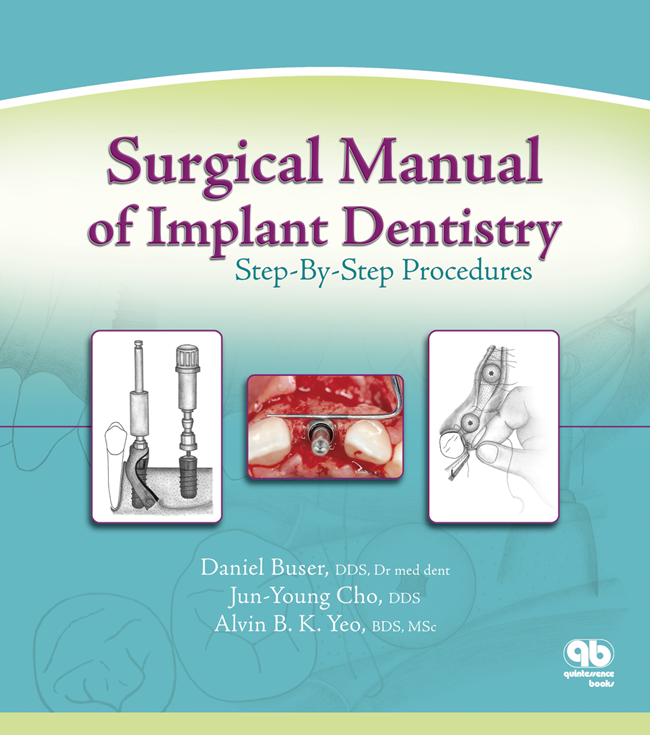 Buser: Surgical Manual of Implant Dentistry