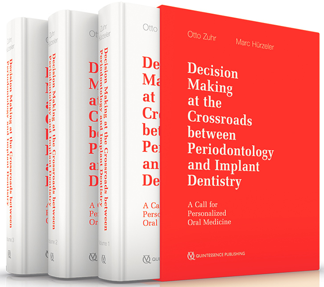 Zuhr: Decision Making at the Crossroads between Periodontology and Implant Dentistry