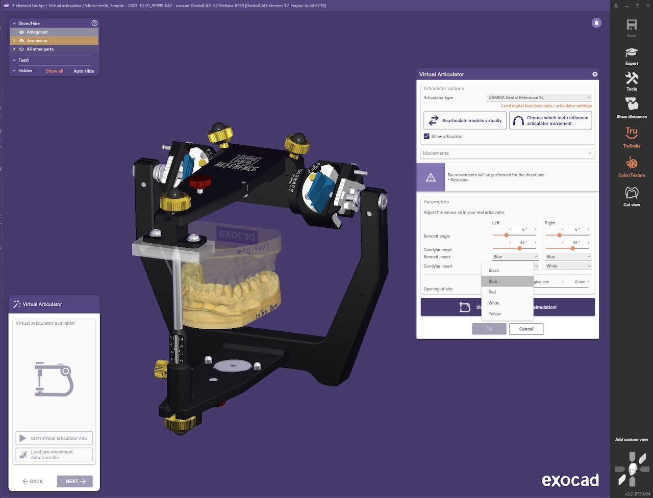 Abb. 1: Zu den weiteren neuen Artikulatoren, die mit DentalCAD 3.2 Elefsina unterstützt werden, gehören auch der KaVo PROTARevo 5B und der Mälzer Dental CORSOART BKR AC-Line. Außerdem wird nun auch die Artikulatorvisualisierung in einem anatomischen Schädelmodell (In-Skull Artikulator) (siehe Abb. 7) unterstützt.