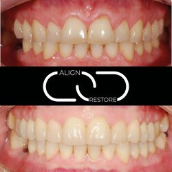 Permadental Permadental