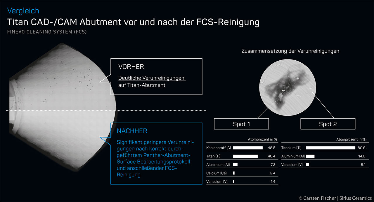 Abb. 1 Rasterelektronenmikroskopische Analyse (REM; D. Duddeck, Berlin) und energiedispersive Röntgenspektroskopie (EDS) eines Titan-CAD/CAM-Abutments vor und nach einer dreistufigen Ultraschallreinigung.