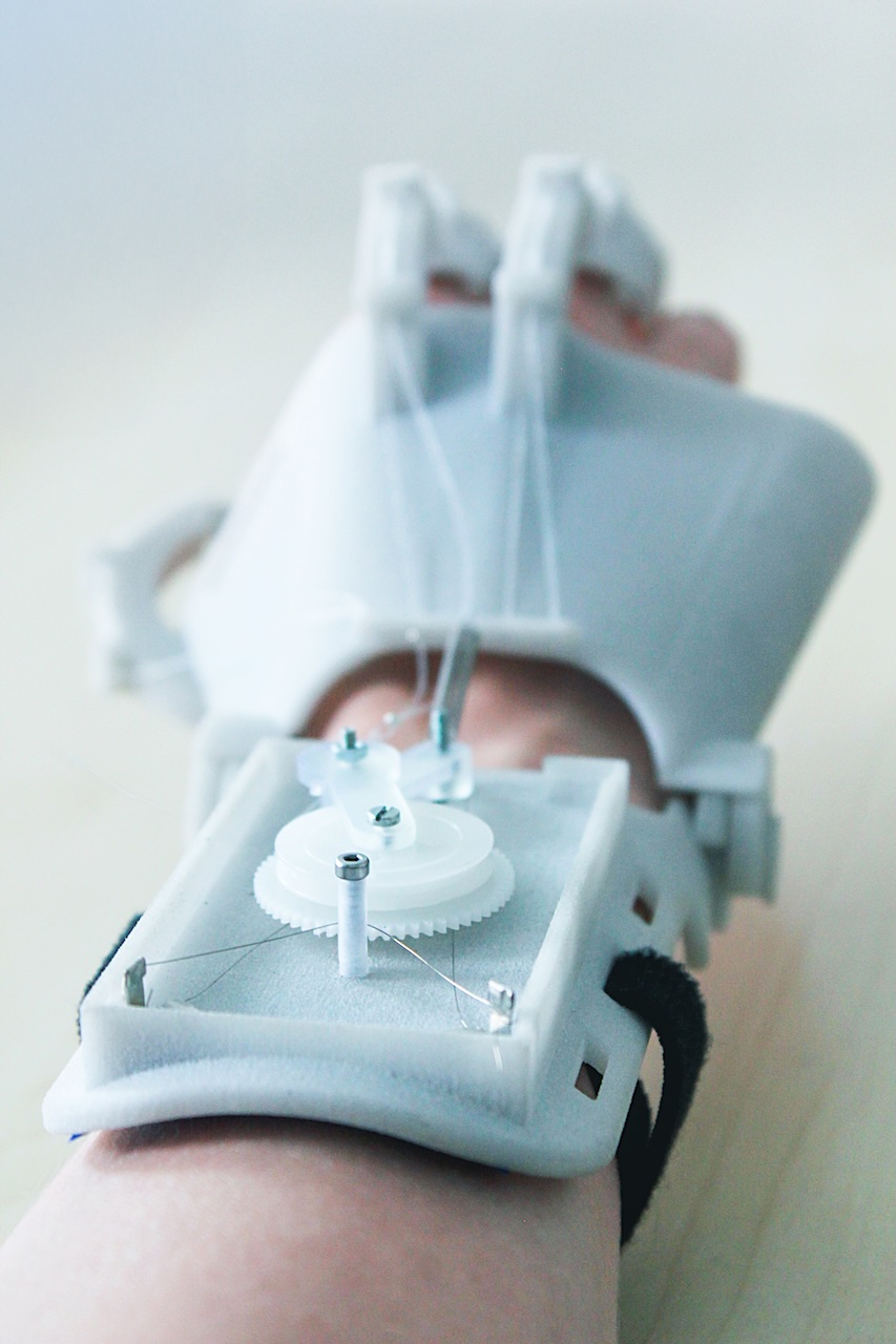 Exoskelett einer rechten Hand vom Unterarm aus gesehen